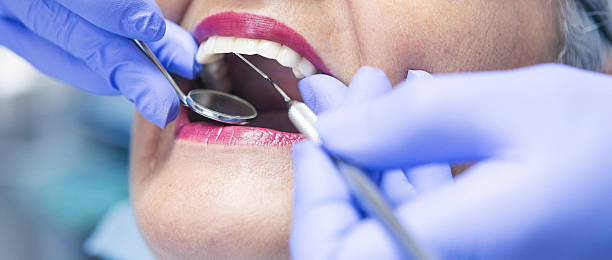 Best Knocked-Out Tooth Emergency  in Montpelier, IN
